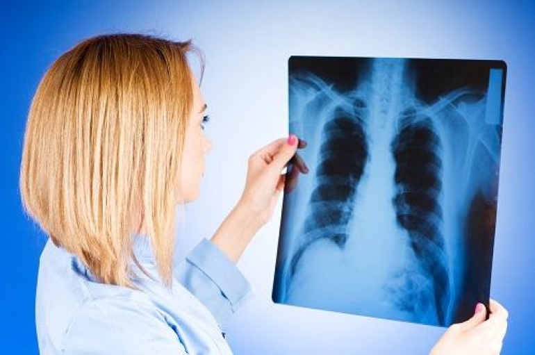 Херсонщина находится на втором месте по заболеваемости туберкулезом