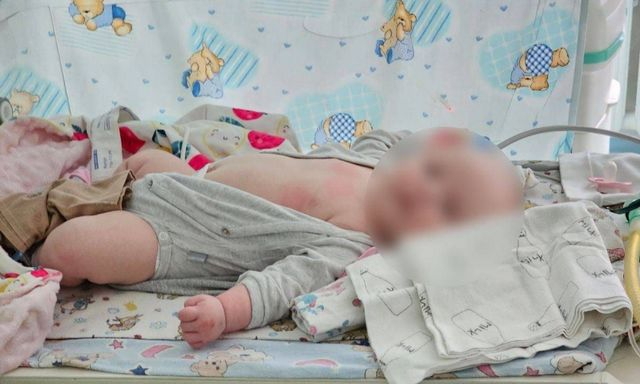 Двухмесячная девочка, раненая оккупантами, идет на поправку, ее маме ампутировали ногу