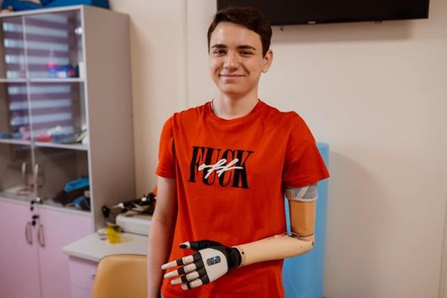 14-летний мальчик из Херсона осваивает бионический протез