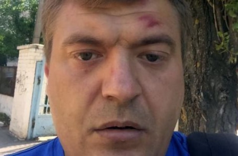 В Украине появились гастролеры, избивающие активистов?
