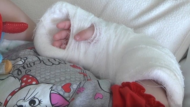 Семимесячную малышку с синяками, ранами и переломом забрали из семьи