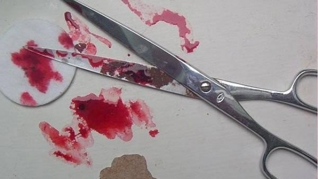 Мужчина зверски избил жену, а затем порезал ножницами